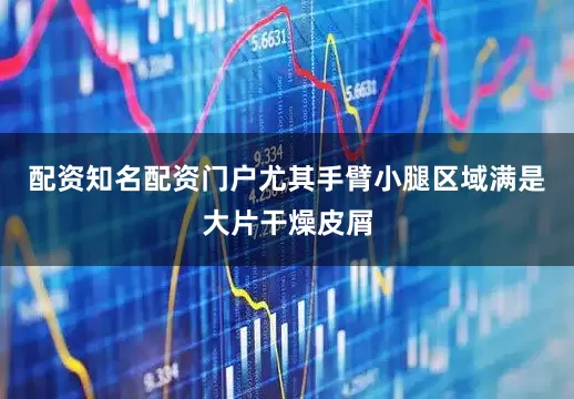 配资知名配资门户尤其手臂小腿区域满是大片干燥皮屑